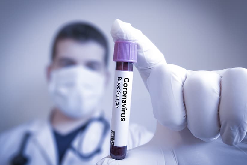 COVID-19: 5212 cazuri de infecție și 16 decese