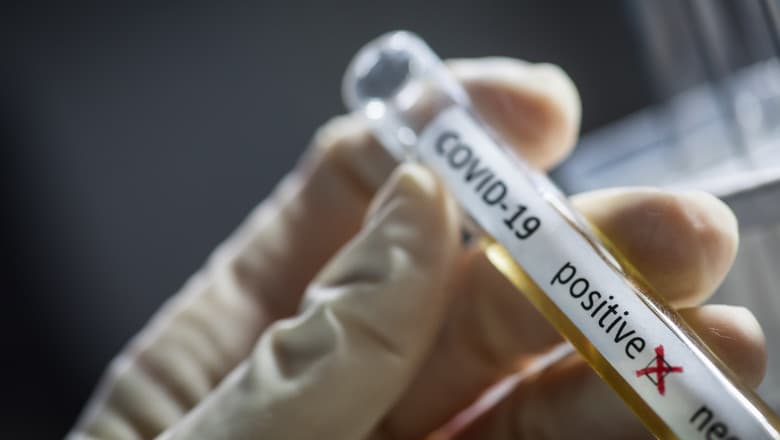 COVID-19: 450 cazuri de infecție și cinci decese