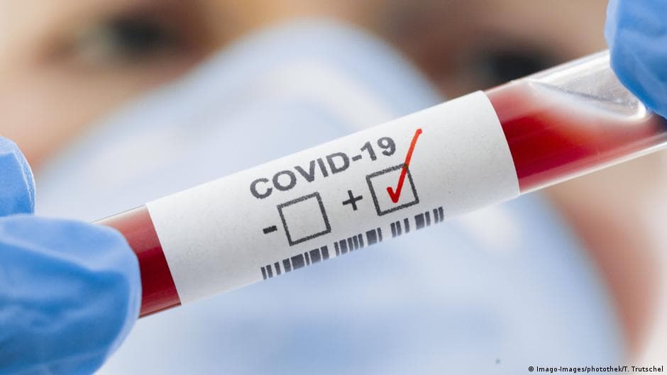COVID-19: 547 de cazuri de infecție și 11 decese
