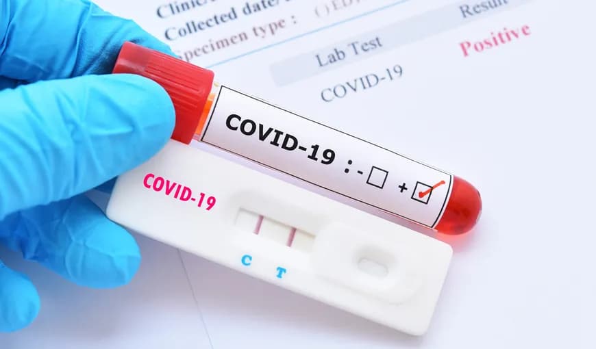 Peste 300 de cazuri noi de COVID-19 înregistrate în Moldova