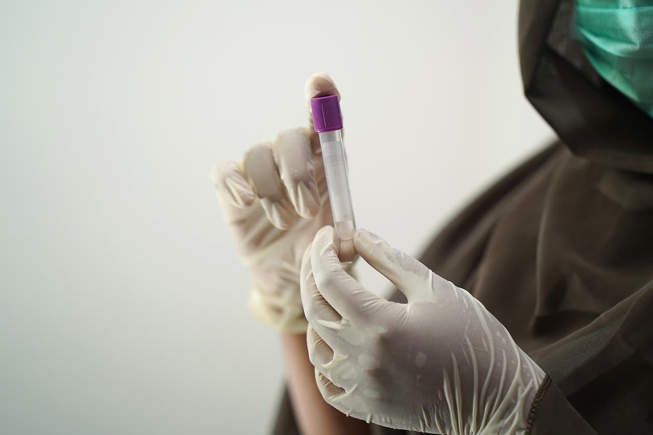 Tratament inovativ pentru cancerul de sânge disponibil în Marea Britanie