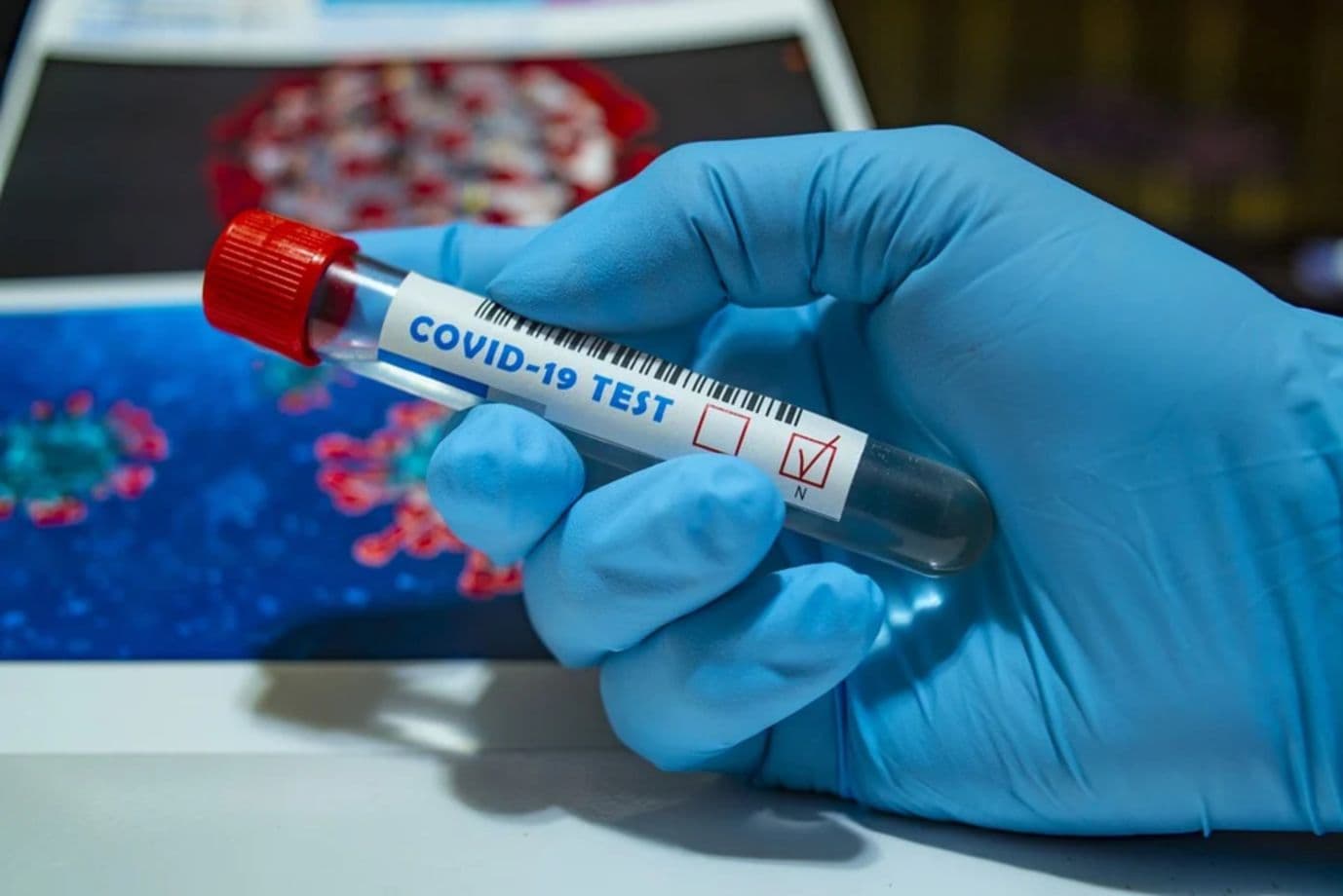 COVID-19: 4794 cazuri de infecție și 25 decese