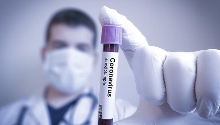 COVID-19: 326 de cazuri de infecție și 5 decese