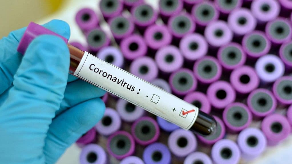 3.690 de cazuri noi de COVID-19
